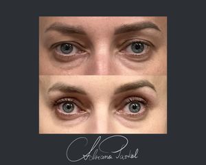 Blefaroplastyka - dr n. med. Adriana Paskal
